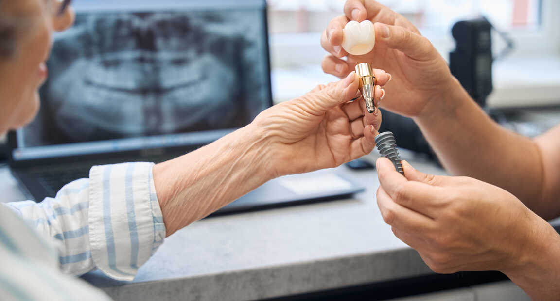 5 érv amellett, hogy mielőbb pótoltassuk a foghiányt