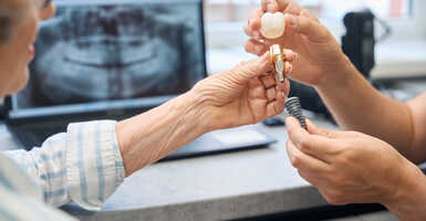 pótoltassuk a foghiányt